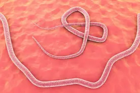 几十年前，人人肚子里几乎都有蛔虫，为何现在很少听说过了？图片