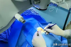 “毁掉许多人一生”的近视手术，真的靠谱吗？图片