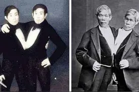 连体兄弟共用肝脏，被称为“怪物”，却娶亲姐妹，生下22个孩子图片