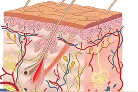 烂脸怎么办，痘斑怎么除图片