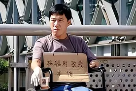 中国首例核辐射受害者：堪称最可怕“不治之症”，半截身体被切除图片