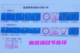 琳琅满目的节育环总有一款适合你图片