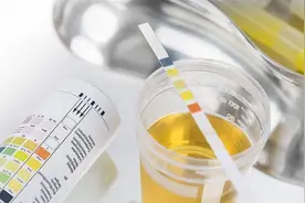 出现泡沫尿该怎么办？图片