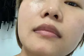 如何改善“唇周发黑”？简单几个习惯，轻松提升颜值图片