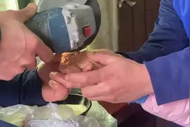 为你戴上戒指的是你的老公，为你取下戒指的可能是你的“蓝朋友”图片