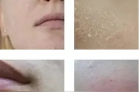 秋冬脸上干燥起皮怎么办？拯救方法，我好像悟到了图片