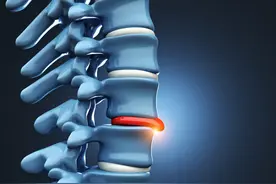 患了腰椎间盘突出怎么办？这8种锻炼方法学起来图片