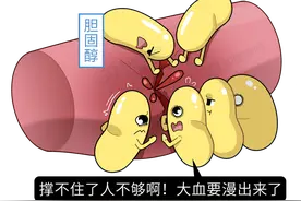 “胆固醇”升高了咋办？不能只是少吃，5招稳控血脂图片