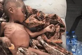 6年前，还记得被白人美女喂水的非洲2岁小男孩，后来他如何了？图片