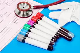 红细胞计数低引起贫血，原来这样补得快图片