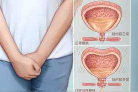 女性的尴尬漏尿（尿失禁）图片