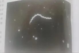 怎样判断梅毒治疗好了 梅毒检验单抗体永远会阳性吗 解读梅毒检验单图片