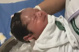 两种头发状态，说明孩子的发育存在异常，可能是营养不良图片