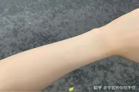 如何快速变白？特别是脸图片