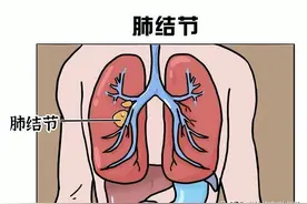 分享一个超猛的散结方，化结节、消囊肿、除息肉，横扫一身包块图片