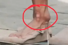 28岁的人50岁的脚！武大靖18年速滑致脚严重变形！金牌就该他得图片