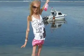 世界上最瘦的女人 网友：行走的骷髅骨 仅40斤图片