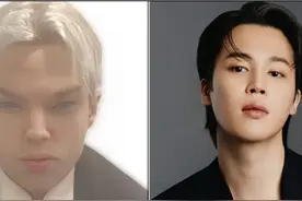 22岁加拿大男星花156万变脸成BTS朴智旻，整形12次不幸过世图片