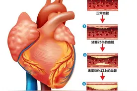 中药奇方三通汤，通心、脑、血管，通全身淤血，散于止痛图片
