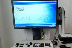 长治市第二人民医院：面瘫后多久能痊愈？肌电图检查给你提供“金指标”图片