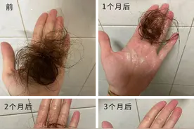 2022防脱洗发水有用吗？6个月真实测评，防脱发洗发水排行榜图片