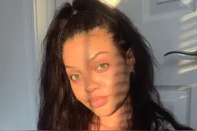 外国四娃妈晒产后肚子：皮肤撑开，腹肌撕裂，这才是最真实的模样图片