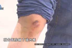 十几天后才发现有点严重，还能补救吗图片