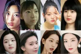 为什么大多明星入圈后，头一件事就是悄咪咪地把颌面调平整了？图片