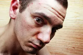 脸色暗黄还长斑，变成黄脸婆！李医生三个小妙招，助你淡斑美容图片