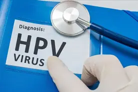 妇科检查出HPV阳性，该怎么办？一定需要治疗吗？图片