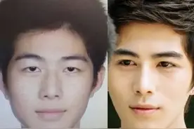 15位明星自曝动脸经历，景甜承认眼皮埋线，宁静一张脸戳了900针图片