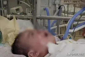 2岁女孩患先天性心脏病，住进ICU后被母亲亲手拔掉氧气管图片