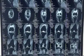 如何在家拍摄清晰的影像片子图片