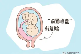 胎盘低了还能自己长上去？图片