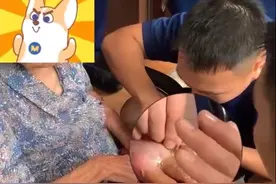 福建三明 老人做饭时手不慎被油锅烫伤，戒指几乎和肉融合在一起图片