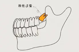 拔牙也分级？来看看天花板级的！图片
