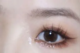 好奇心！异物掉进眼睛里之后，最终去哪里了？图片