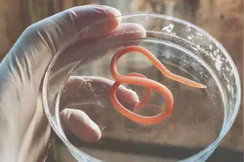 七八十年代，几乎每人肚里都生过蛔虫，为啥现在却没人感染蛔虫了图片