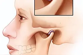 张不开嘴？大小脸？教你「颞下颌关节紊乱」的诊断与治疗原则图片