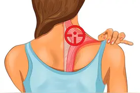 关于斜方肌代偿的6个真相，女生得看！图片