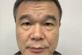 55岁去外地做眼袋手术，跑了三趟的亲身经历，给大家的忠告图片