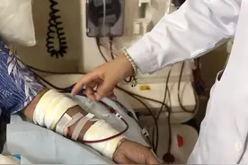 一周进行三次血液透析，生命能延续几年？肾内科医师告诉你答案图片