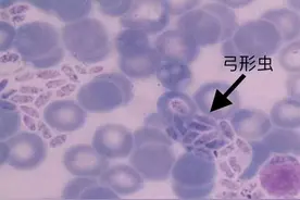 关于弓形虫，你想了解的都在这儿图片