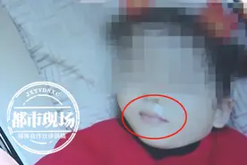 家长用“封口贴”强制孩子“闭嘴”睡觉？医生认为：不可取图片