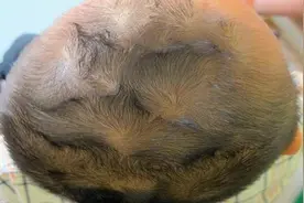 孩子头上的“旋”代表着什么？与智商、性格有关吗？告诉你答案图片