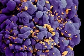 我们离艾滋病治愈还有多远？图片