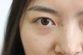 “左眼皮跳跳，好运要来到”，眼皮跳动真的是凶吉的征兆吗？图片