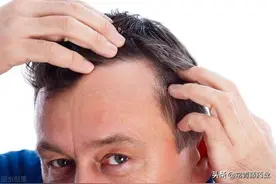 非那雄胺什么时候开始服用？有没有年龄限制？每天什么时间服用？图片