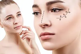 朋友做双眼皮失败，自己不敢尝试，没想到术后效果很不错图片