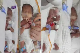 4胞胎不同天出生，还在济南住院，父亲为筹药费瘦20斤图片